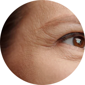 Wrinkles